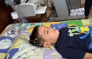 electroencefalograma niños